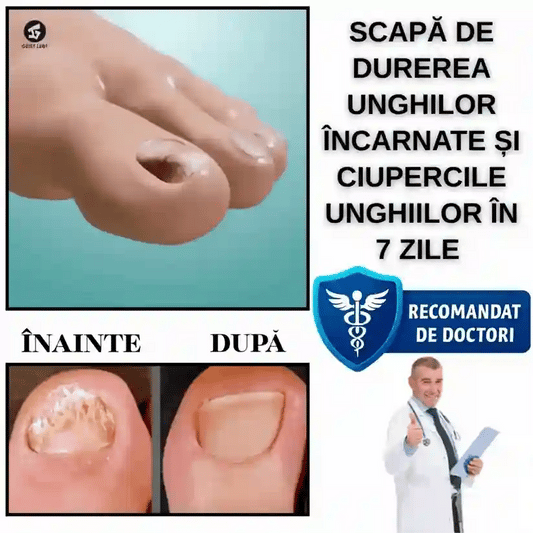 Plasture Unghii Încarnate - UnghiaFix™ 1+1 GRATIS
